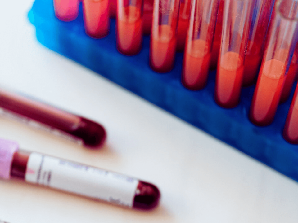 Close-up view of organized blood samples for DUI testing in Arizona.