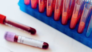 DUI Blood Test Consent vs Refusal in Arizona